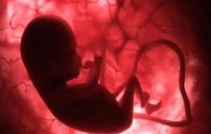 تاثیر داروی جلوگیری از سقط جنین بر افزایش خطر سرطان+جزئیات