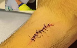 یکی از ماموران اورژانس استان با ایثارگری  مانع از دست دادن جان یکی از هم استانی های شد