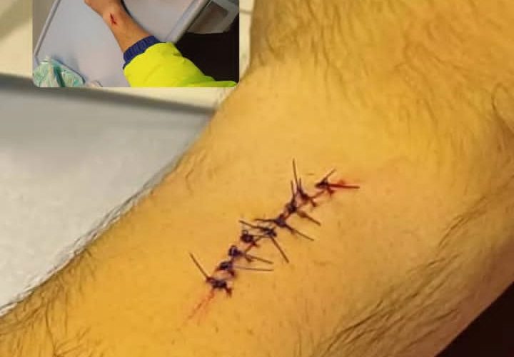 یکی از ماموران اورژانس استان با ایثارگری مانع از دست دادن جان یکی از هم استانی های شد یکی از ماموران اورژانس استان با ایثارگری مانع از دست دادن جان یکی از هم استانی های شد